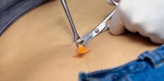 Das Piercen Piercing Bauchnabel
