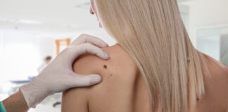 Muttermal – Bedeutung und Erklärung – Tattoo & Piercing Szene